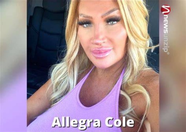 
Allegra Cole Age, Bio, Net Worth, Married, Husband, Surgery