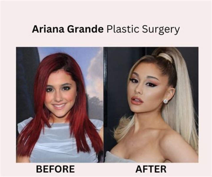 Ariana Grande Chirurgie