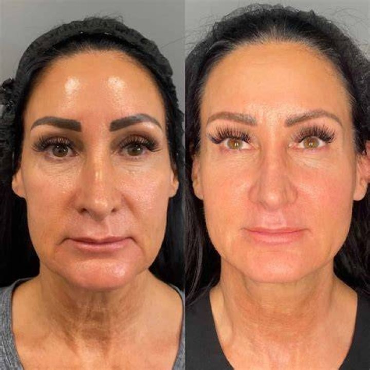 Before and After Photos Compared