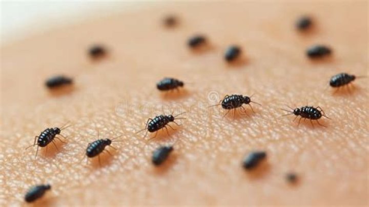 Bugs Crawling Under Your Skin? It’s All in Your Mind