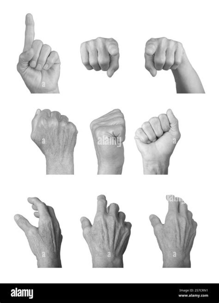 Clenched fists | Dementia Support Forum