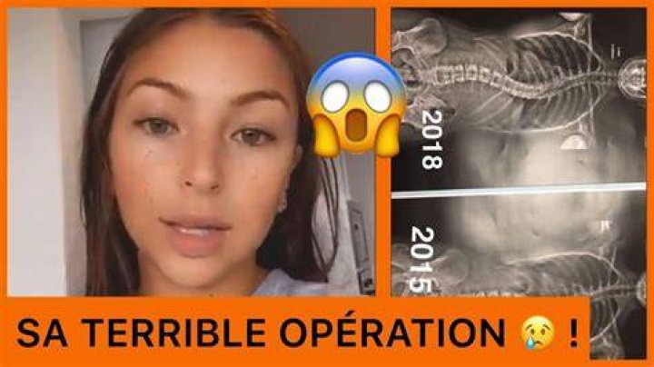 Eva Queen Avant Chirurgie: Evolution esthétique et réponse publique