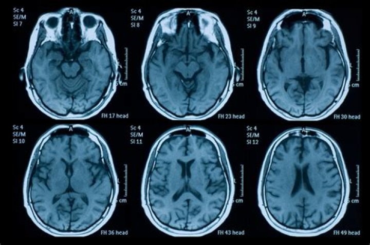 How Neuroimaging Can Yield Better Diagnostic Information