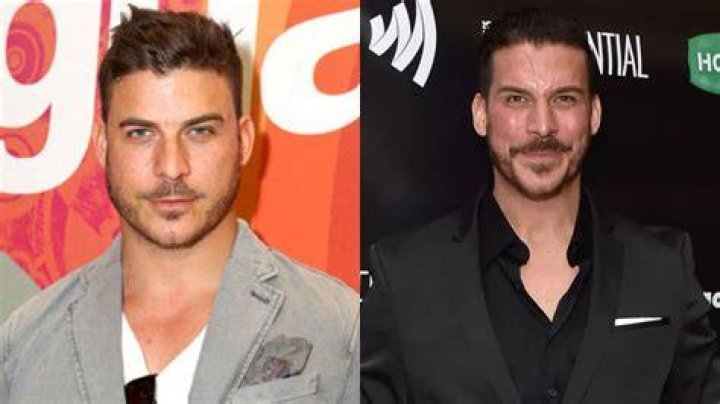 Jax Taylor's Plastic Surgery Includes Boob Job & Nose Jobs