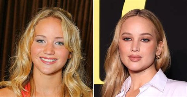Jennifer Lawrence Had a Candid Conversation with Kylie Jenner on Plastic Surgery Speculations