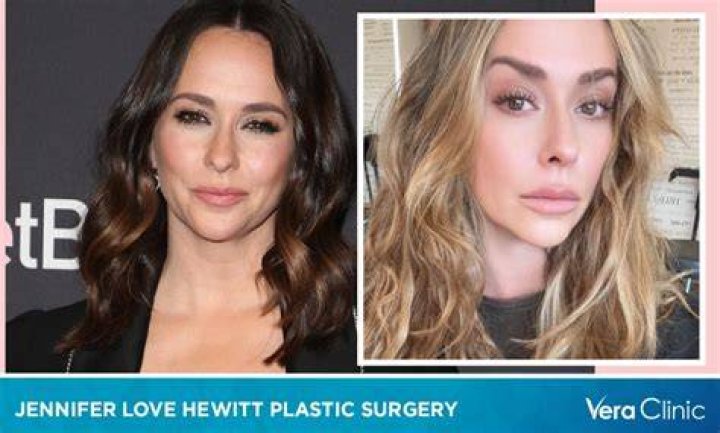 Jennifer Love Hewitt’s Plastic Surgery: The Truth Behind Her Beauty