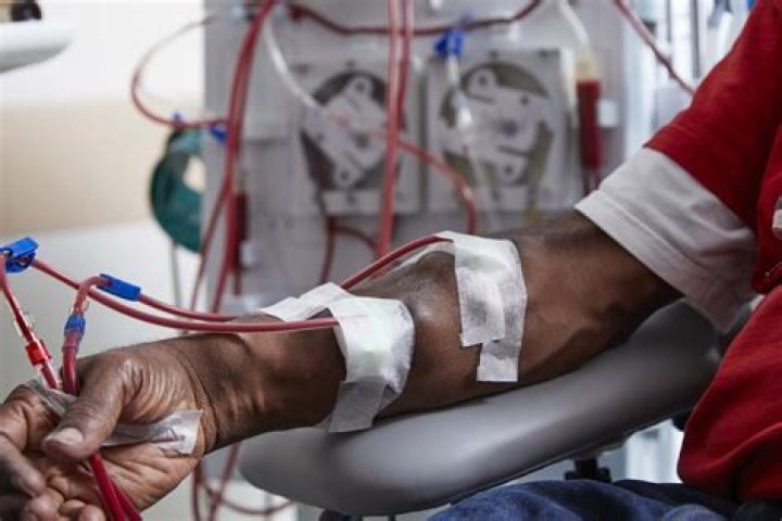 Prescription of an intermittent haemodialysis dose using urea kinetic modelling is feasible in the critically ill patient - ePrints