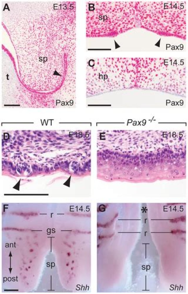 The Formation of Endoderm-Derived Taste Sensory Organs Requires a Pax9-Dependent Expansion of Embryonic Taste Bud Progenitor Cells - ePrints