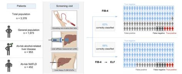 The NAFLD fibrosis score: A noninvasive system that identifies liver fibrosis in patients with NAFLD - ePrints
